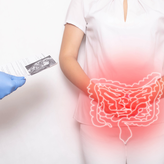 causes bowel obstruction